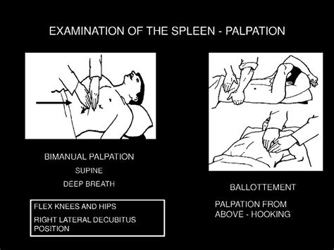 scratch test spleen|spleen enlargement exam questions.